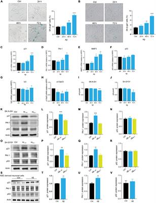 Alzheimer’s Amyloid-β Accelerates Human Neuronal Cell Senescence Which Could Be Rescued by Sirtuin-1 and Aspirin